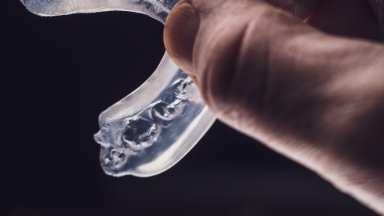Smart mouthguards tracking head impact data in football?